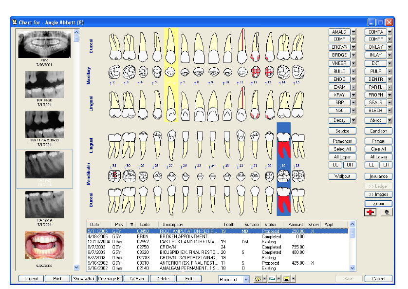 Electronic Dental Patients Record