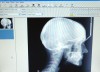 Figure 5. A digital extraoral radiographic image is displayed on the computer monitor. This particular radiographic projection is a lateral head plate. (Patterson Dental Supply, Inc)