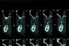 Figure 26 – CT scan; cross-section of the patient’s posterior maxilla and mandible. Note the gutta-percha shows up as a white vertical cylinder between the arches.