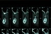 Figure 26 – CT scan; cross-section of the patient’s posterior maxilla and mandible. Note the gutta-percha shows up as a white vertical cylinder between the arches.