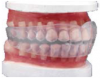 Figure 15. Tooth positioner.