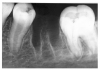 Figure 17 - Recent Extraction Site