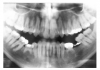 Figure 28 - Congenital Hypodontia