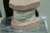 Articulated Models (Courtesy of Dux Dental)