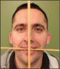 Figure 12 - Occlusal and Midsagittal Planes