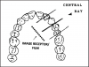 Figure 17 - Maxillary Canines