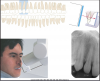 Figure 19 - Maxillary Canines