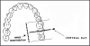 Figure 23 - Maxillary Molars