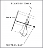 Figure 27 - Mandibular Central/Lateral Incisors