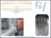 Figure 28 - Mandibular Central Lateral Incisors