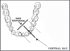 Figure 29 - Mandibular Canine