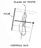 Figure 30 - Mandibular Canine