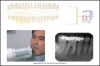 Figure 34 - Mandibular Premolars