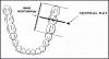 Figure 35 - Mandibular Molars