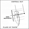 Figure 36 - Mandibular Molars