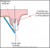 Figure 50 - Maxillary Molars