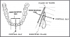 Figure 52 - Mandibular Central/Lateral Incisors