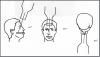 Figure 65 - Maxillary Topographical Occlusal