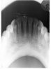 Figure 66 - Mandibular Topographical Occlusal Image