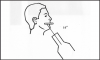 Figure 67 - Mandibular Topographical Occlusal