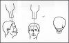 Figure 69 - Maxillary Vertex Occlusal