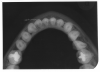 Figure 70 - Mandibular Cross-Sectional Occlusal Image