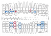 Fig 3. Charting Existing Conditions Manually.