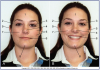 Figure 1 – Regions of the Face – smiling and at rest (Courtesy of Modern Dental Assisting, 10th Edition, Bird et al, Figure 10.1). There are nine regions of the face as shown in the photograph.