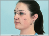 Figure 2 – Features of the Face (Courtesy of Modern Dental Assisting, 10th Edition, Bird et al, Figure 10.2). This photograph highlights different facial features.