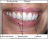 Figure 3 – Frontal View of the Lips (Courtesy of Modern Dental Assisting, 10th Edition, Bird et al, Figure 10.3). This photograph points out the parts of the lips.