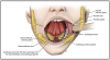 Figure 10 – The Major Salivary Glands and Associated Structures (Courtesy of Illustrated Anatomy of the Head and Neck, 3rd Ed, Figure 2-17). Diagram of location of major salivary glands.