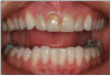 Figure 12 – Maxillary and Mandibular Teeth View