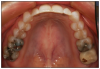 Figure 20 – Maxillary Arch View