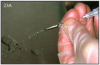 Figure 23A – Top: proper cleaning of the surgical drills by irrigating them with water to remove blockages