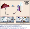 Figure 2 – Connection between periodontal disease and atherosclerosis. From: Dave S, Batista EL Jr, Van Dyke TE: Cardiovascular disease and periodontal diseases: commonality and causation. Compend Cont Educ Dent. 2004; 25(7) (Suppl 1):26-37.