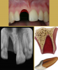 Fig 6. Images of Avulsion