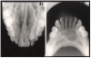 Figure 3 – Occlusal Images