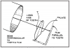 Figure 8 – Principles of the Paralleling Technique