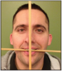 Figure 12 – Occlusal and Midsagittal Planes