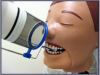 Figure 16 – XCP placement for Maxillary Central/Lateral Incisors