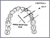 Figure 17 – Maxillary Canines