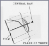 Figure 18 – Maxillary Canines