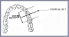 Figure 20 – Maxillary Premolars