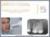 Figure 25 – Maxillary Molars