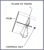 Figure 27 – Mandibular Central/Lateral Incisors