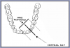 Figure 29 – Mandibular Canine