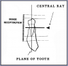 Figure 33 – Mandibular Premolars