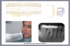 Figure 34 – Mandibular Premolars