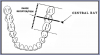 Figure 35 – Mandibular Molars