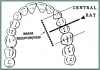 Figure 46 – Maxillary Premolars